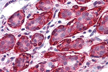 THRA Antibody