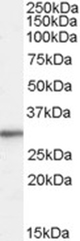THRA Antibody