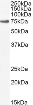 MAP3K7 Antibody