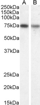 MAP3K7 Antibody