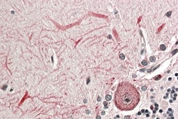 NCAM1 Antibody