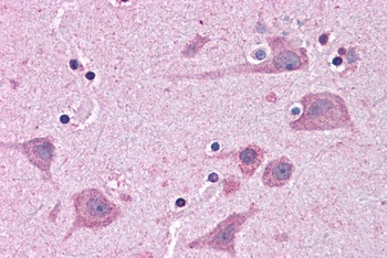 TNKS1BP1 Antibody