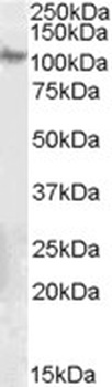 SYNGR2 Antibody