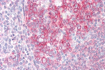 SWAP70 Antibody