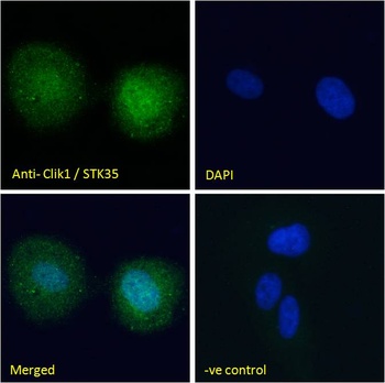 STK35 Antibody