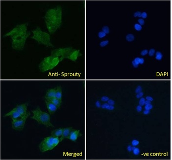 Sprouty Antibody
