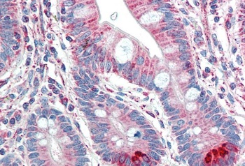 TMPRSS5 Antibody