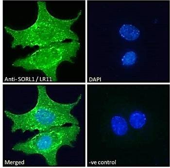 SORL1 Antibody