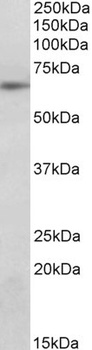 SOCS5 Antibody
