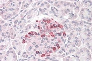 SOCS4 Antibody