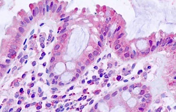 BTBD7 Antibody