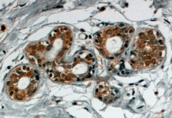 SNX5 Antibody