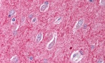 SNX26 Antibody