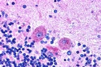 SNX26 Antibody