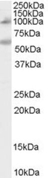 SNAI1 Antibody