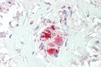 Smek1 Antibody