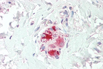 SMEK1 Antibody