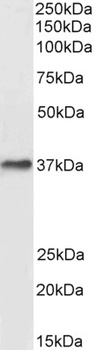 SLC9A3R2 Antibody