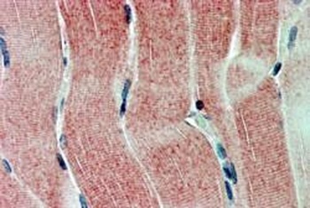 SIRT4 Antibody