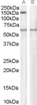 SIPA1 Antibody