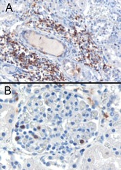 SH3BP1 Antibody