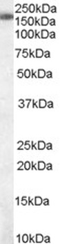 SH2D1A Antibody