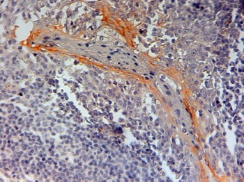 HTR1B Antibody
