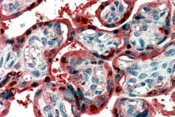 SCN5A Antibody