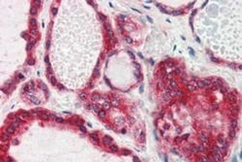 SBP2 Antibody
