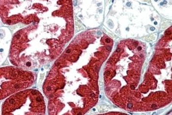 KIAA1881 Antibody