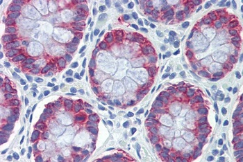 S100A4 Antibody