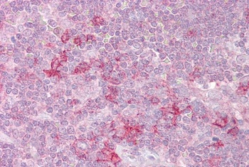 RP6-213H19 Antibody
