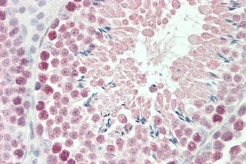 Robo1 Antibody