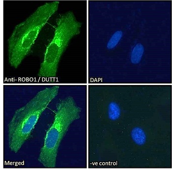 ROBO1 Antibody