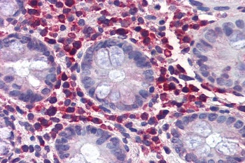 Ro52 Antibody