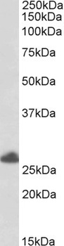 TRIM40 Antibody