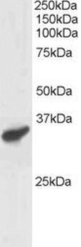 PCGF3 Antibody