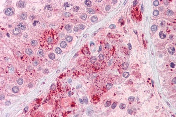 RIF1 Antibody
