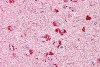 RIF1 Antibody