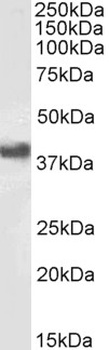 RICTOR Antibody
