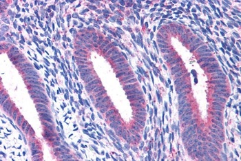 Ribosomal Protein L22 Antibody