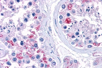 Ribosomal Protein L22 Antibody