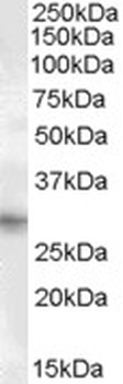 Ribosomal Protein L22 Antibody