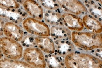 RNF34 Antibody