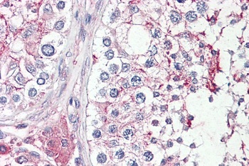 RASSF7 Antibody