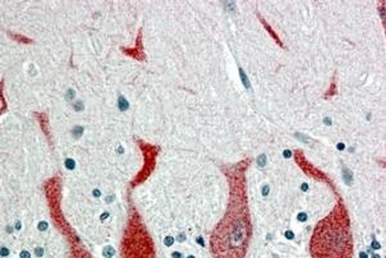 RARA Antibody