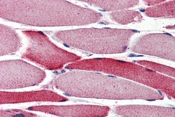RARA Antibody