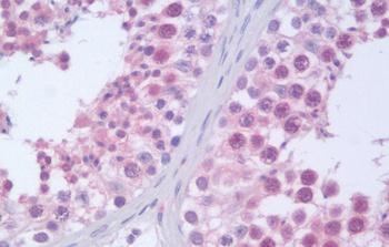 RANBP9 Antibody