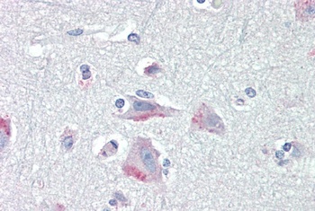 RAD9A Antibody