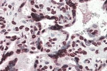 RAB11FIP1 Antibody